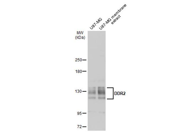 DDR2 Antibody in Western Blot (WB)