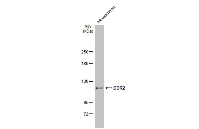 DDR2 Antibody in Western Blot (WB)