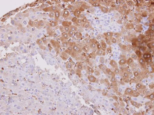 HSD3B2 Antibody in Immunohistochemistry (Paraffin) (IHC (P))