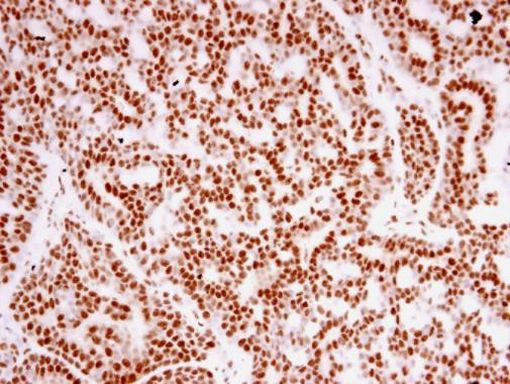 TAF15 Antibody in Immunohistochemistry (Paraffin) (IHC (P))