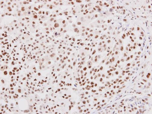 NRF1 Antibody in Immunohistochemistry (Paraffin) (IHC (P))