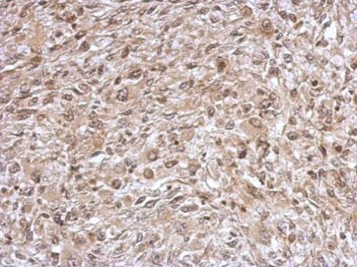 TrxR1 Antibody in Immunohistochemistry (Paraffin) (IHC (P))