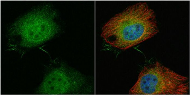 PLS3 Antibody in Immunocytochemistry (ICC/IF)