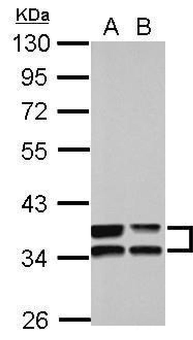 Annexin A3 Antibody in Western Blot (WB)