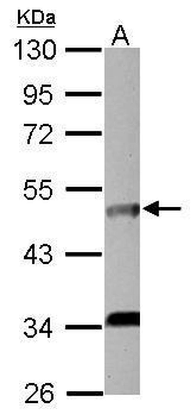 IL5RA Antibody in Western Blot (WB)
