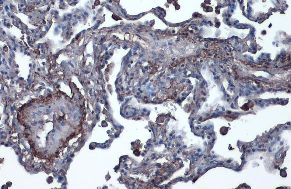 Vitronectin Antibody in Immunohistochemistry (Paraffin) (IHC (P))