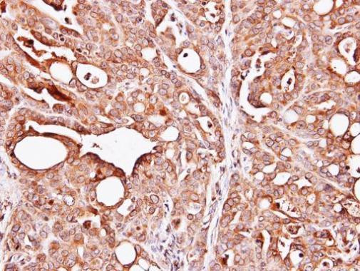 PAPSS1 Antibody in Immunohistochemistry (Paraffin) (IHC (P))