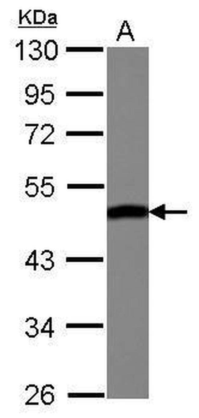ENO3 Antibody in Western Blot (WB)
