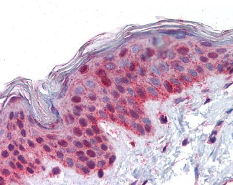 PLK1 Antibody in Immunohistochemistry (Paraffin) (IHC (P))