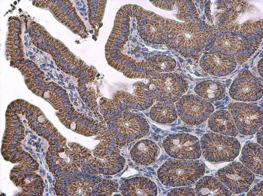 VDAC2 Antibody in Immunohistochemistry (Paraffin) (IHC (P))