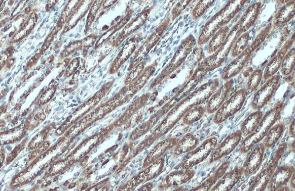 VDAC2 Antibody in Immunohistochemistry (Paraffin) (IHC (P))