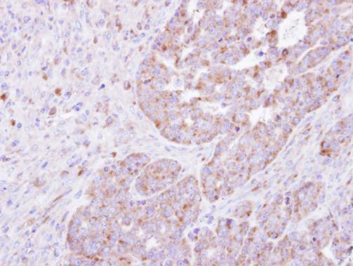 FARSA Antibody in Immunohistochemistry (Paraffin) (IHC (P))