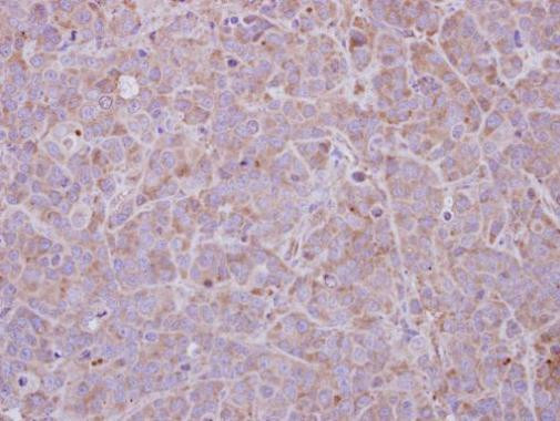 MAGEB1 Antibody in Immunohistochemistry (Paraffin) (IHC (P))