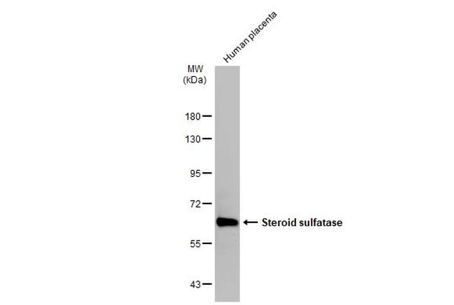 STS Antibody in Western Blot (WB)