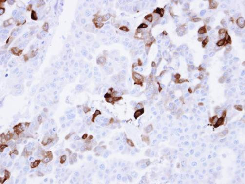 Carbonic Anhydrase II Antibody in Immunohistochemistry (Paraffin) (IHC (P))