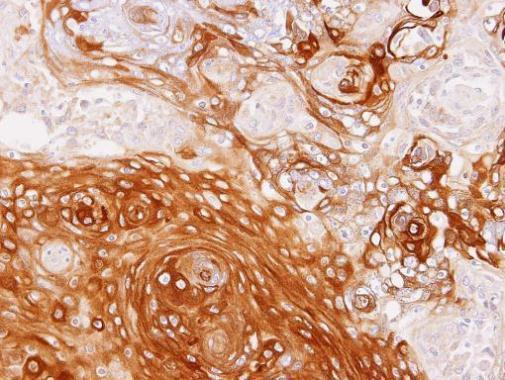 GBP1 Antibody in Immunohistochemistry (Paraffin) (IHC (P))