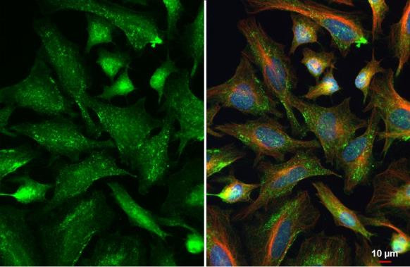 VPS26A Antibody in Immunocytochemistry (ICC/IF)