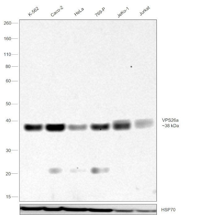 VPS26A Antibody in Western Blot (WB)