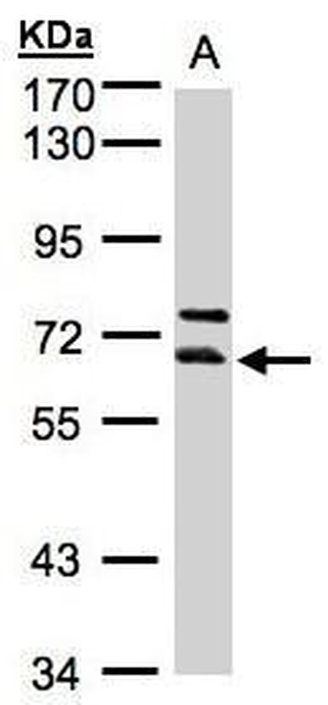 THUMPD3 Antibody in Western Blot (WB)