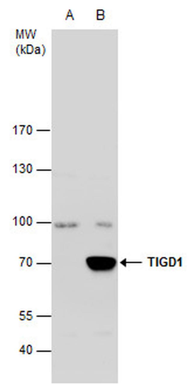 TIGD1 Antibody in Western Blot (WB)