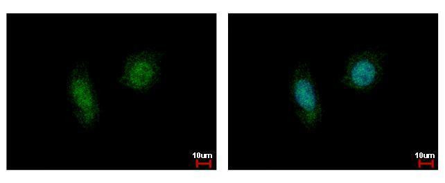 CK2 alpha-1 Antibody in Immunocytochemistry (ICC/IF)