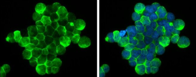 Zap-70 Antibody in Immunocytochemistry (ICC/IF)