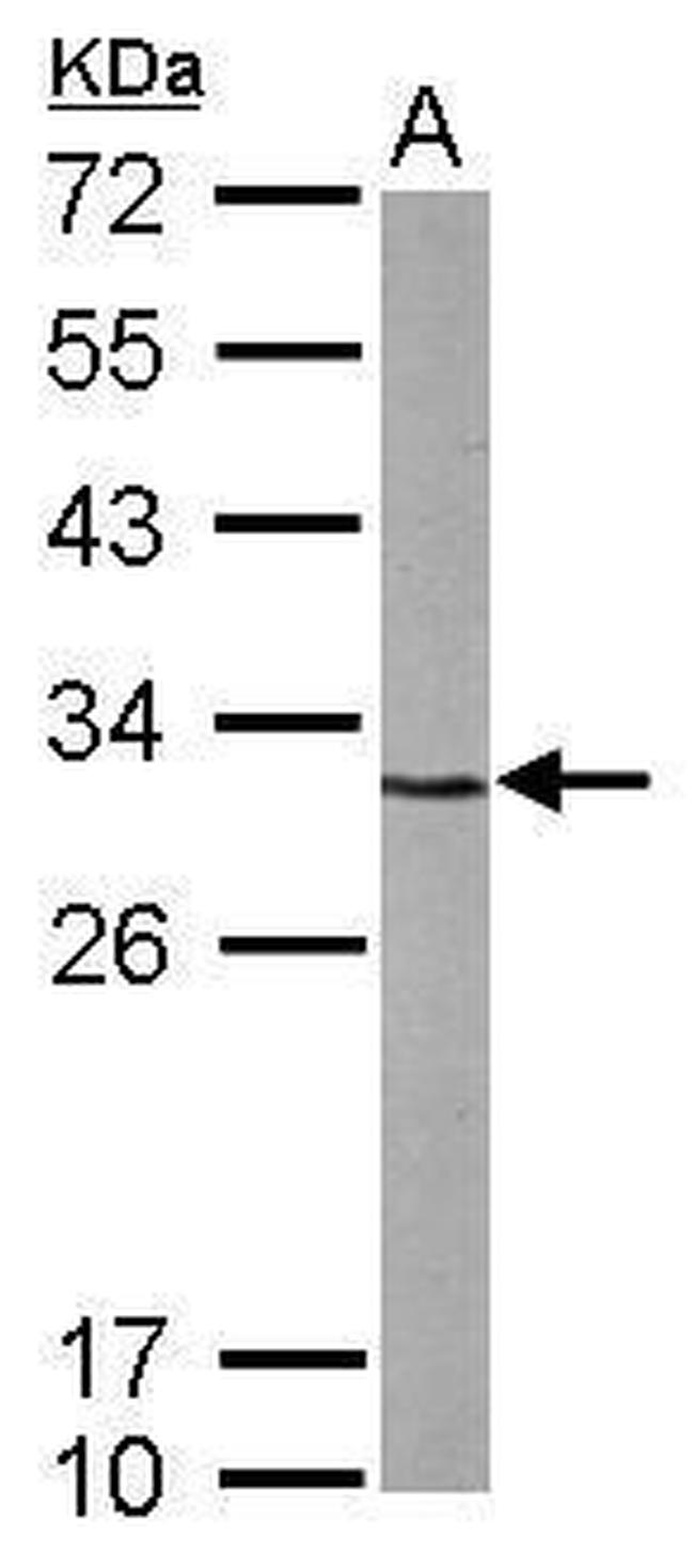 CDK5 Antibody in Western Blot (WB)