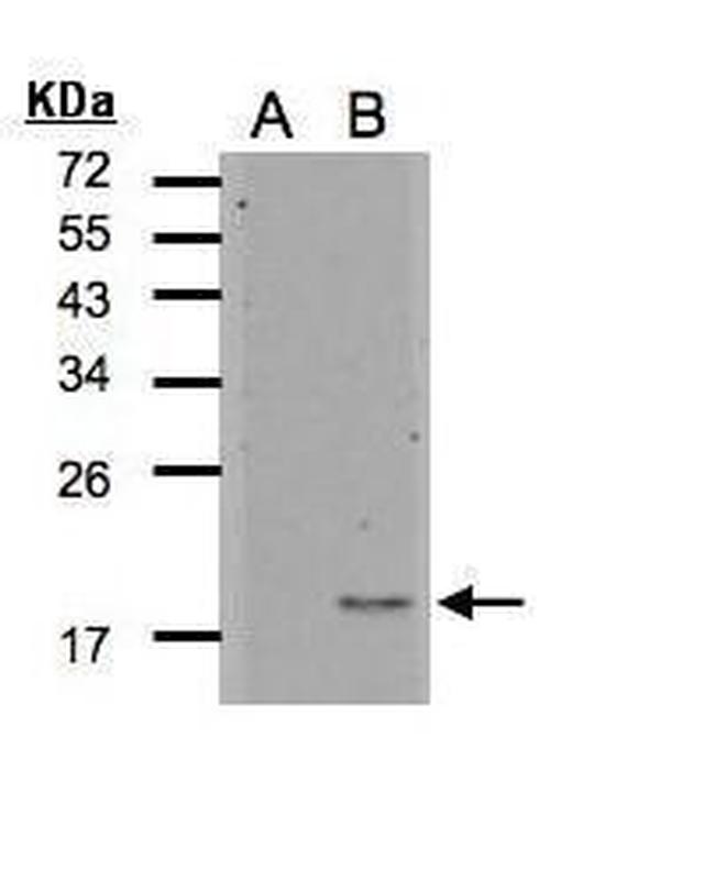 IL1F5 Antibody in Western Blot (WB)