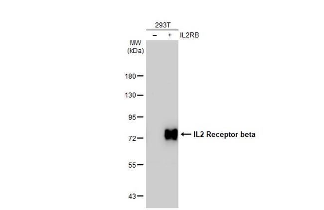 CD122 Antibody in Western Blot (WB)