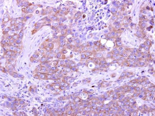 GIMAP5 Antibody in Immunohistochemistry (Paraffin) (IHC (P))