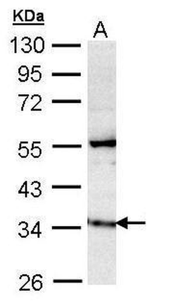 GIMAP5 Antibody in Western Blot (WB)