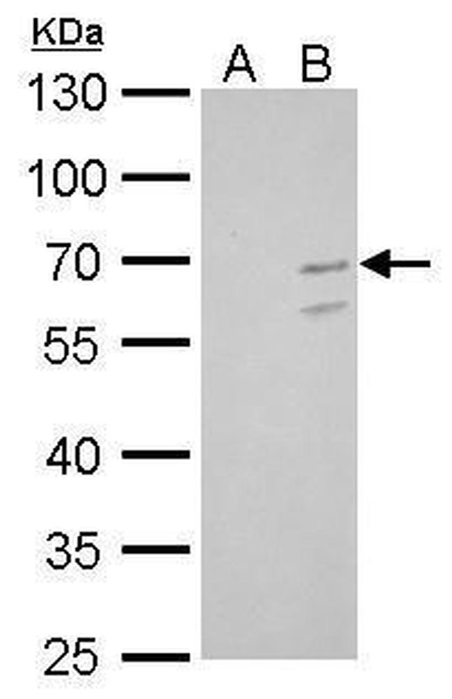 KLF10 Antibody in Western Blot (WB)