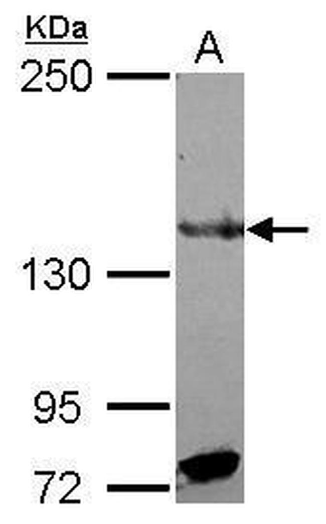 RFX1 Antibody in Western Blot (WB)