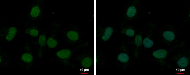 MED8 Antibody in Immunocytochemistry (ICC/IF)