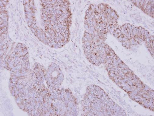 PSTPIP2 Antibody in Immunohistochemistry (Paraffin) (IHC (P))