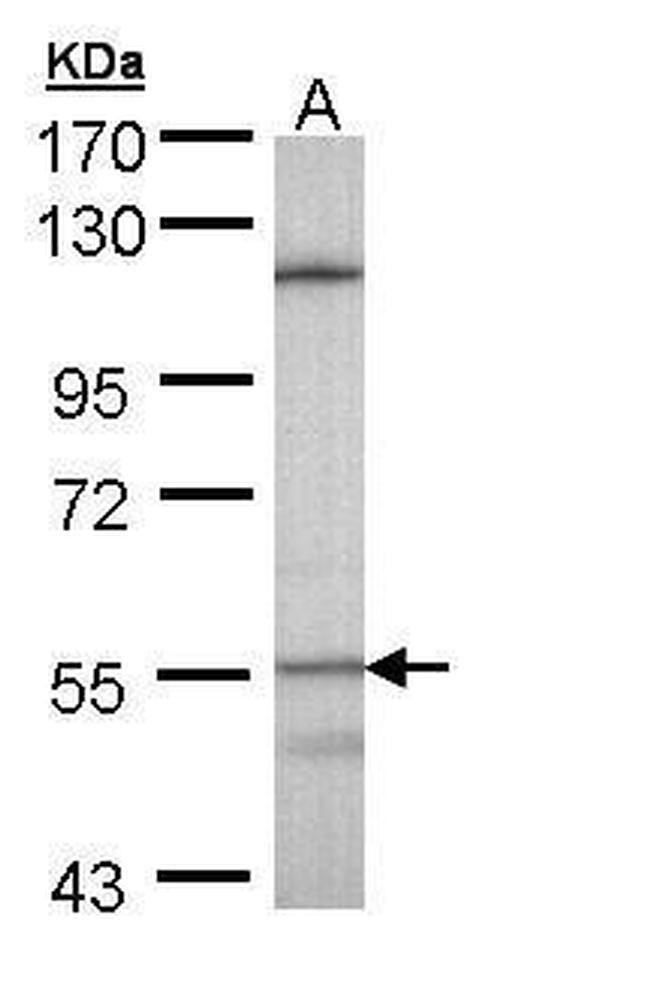 CYP4B1 Antibody in Western Blot (WB)