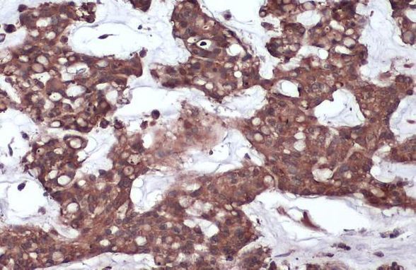 GP130 Antibody in Immunohistochemistry (Paraffin) (IHC (P))