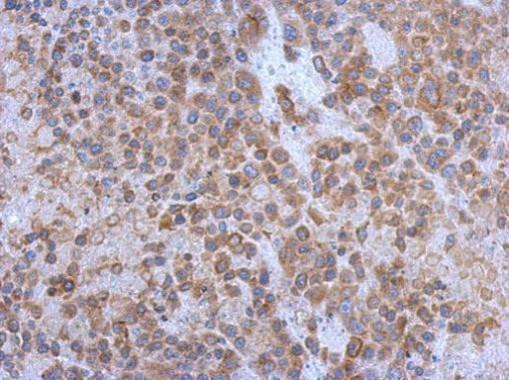 GP130 Antibody in Immunohistochemistry (Paraffin) (IHC (P))