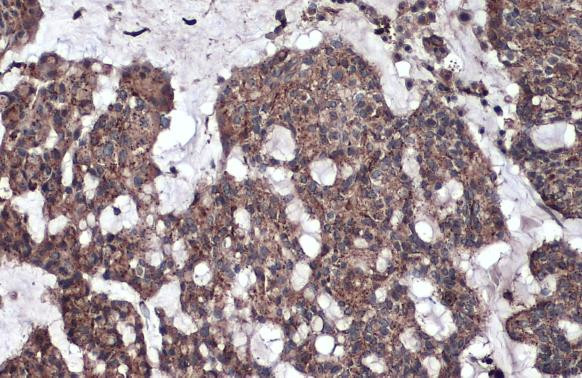 LYAG Antibody in Immunohistochemistry (Paraffin) (IHC (P))