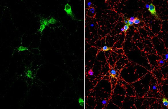 COL6A1 Antibody in Immunocytochemistry (ICC/IF)