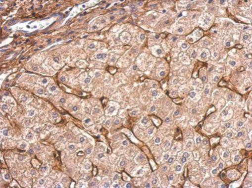 COL6A1 Antibody in Immunohistochemistry (Paraffin) (IHC (P))