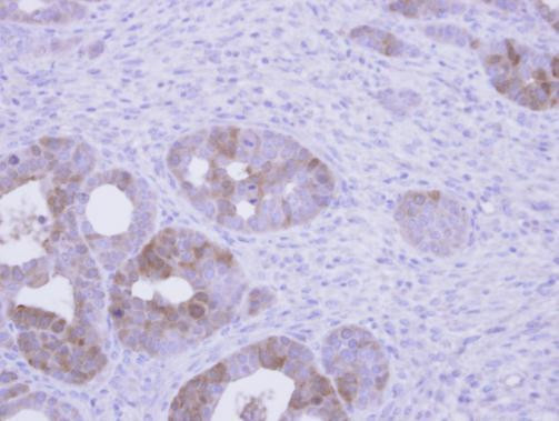 Villin Antibody in Immunohistochemistry (Paraffin) (IHC (P))