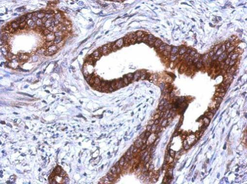 PKP1 Antibody in Immunohistochemistry (Paraffin) (IHC (P))