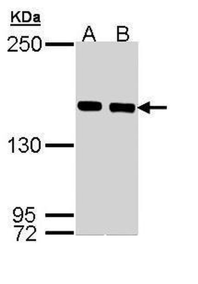 SMC1 Antibody in Western Blot (WB)