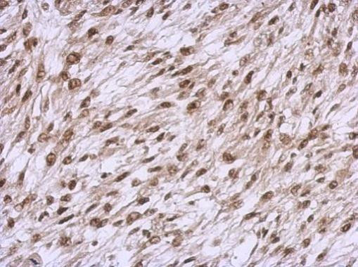 YY1 Antibody in Immunohistochemistry (Paraffin) (IHC (P))