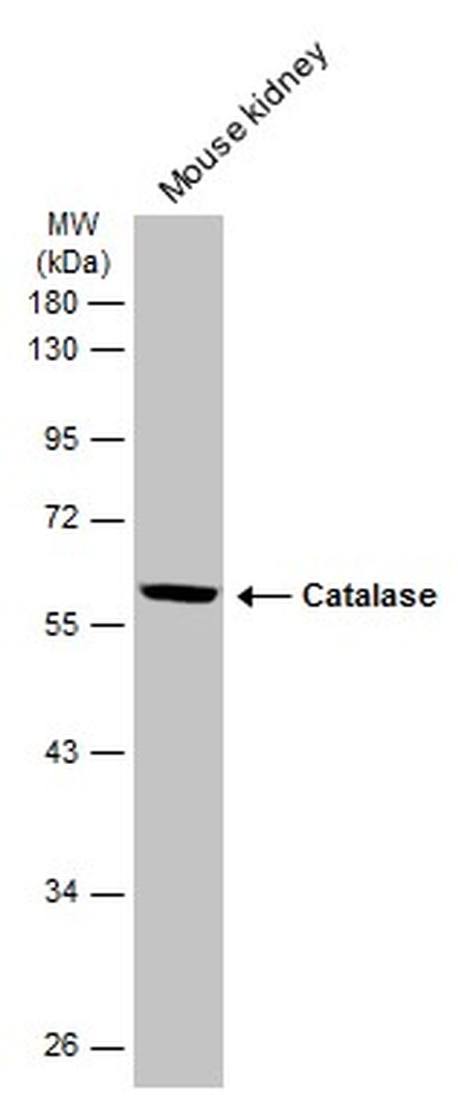 Catalase Antibody in Western Blot (WB)