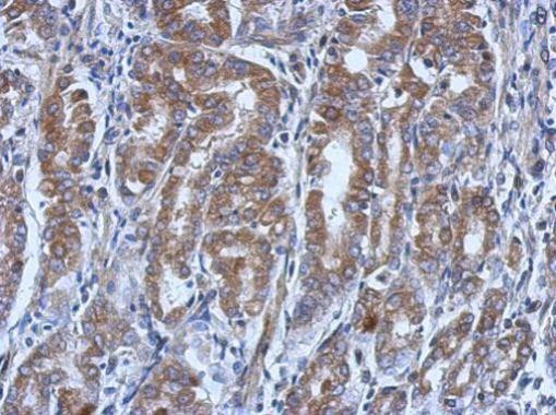 UBE4A Antibody in Immunohistochemistry (Paraffin) (IHC (P))