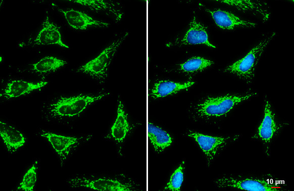 SLC25A6 Antibody in Immunocytochemistry (ICC/IF)