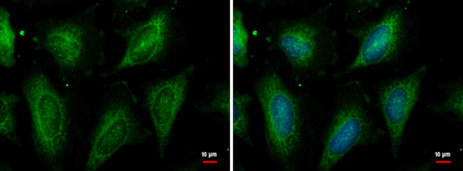 HSC70 Antibody in Immunocytochemistry (ICC/IF)