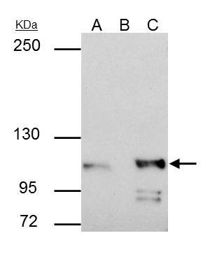 alpha Catenin Antibody in Immunoprecipitation (IP)